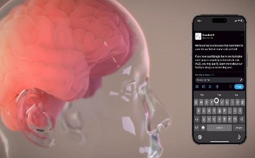 Парализованный пациент играет в шахматы онлайн с помощью чипа Neuralink