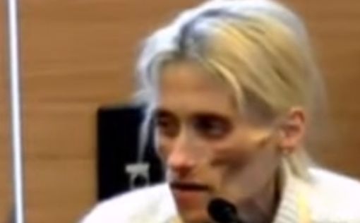 35-летняя модель Карин Бауман скончалась от анорексии