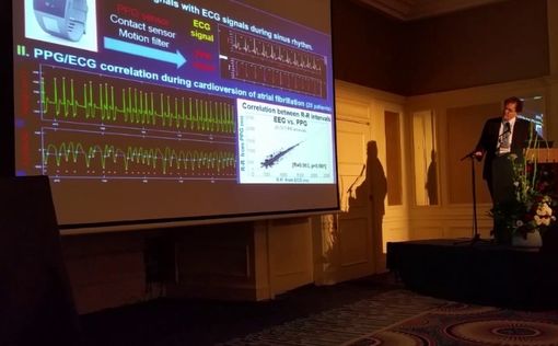 Умные часы CardiacSense привлекли 3,5 миллионов долларов